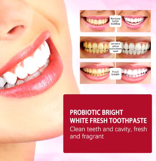 Probiotic SP-4 whitening toothpaste 120g for brightening and oral care.