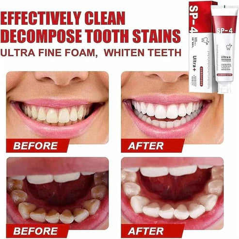 120g Probiotic SP-4 toothpaste for teeth whitening and gum health.