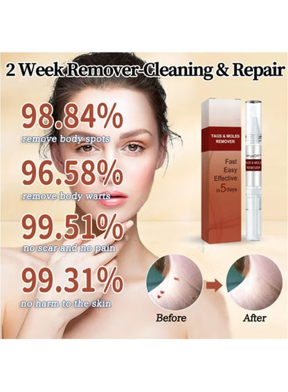 Skin Tag & Mole Remover Pen with Tea Tree Oil.