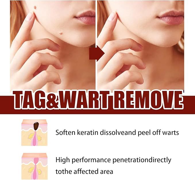 Wipe-Off Tags & Moles Remover Pen – Natural Tea Tree Oil Skin Tag & Mole Removal Care for Face, Neck & Body