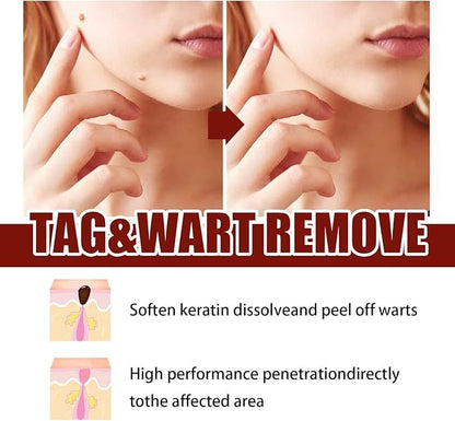 Wipe-Off Tags & Moles Remover Pen – Natural Tea Tree Oil Skin Tag & Mole Removal Care for Face, Neck & Body