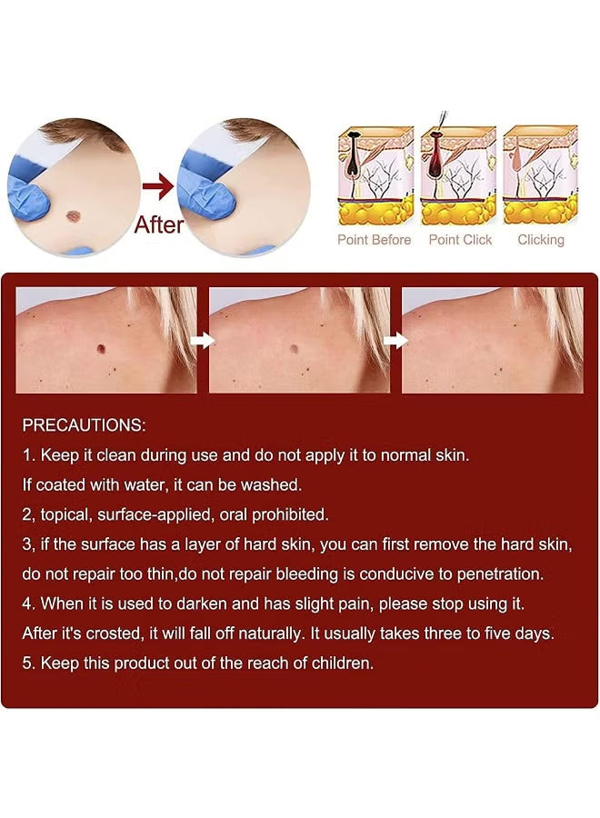 Skin Tag & Mole Remover Pen with Tea Tree Oil.