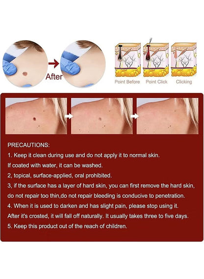 Skin Tag & Mole Remover Pen with Tea Tree Oil.