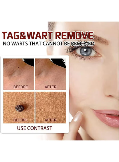 Wipe-Off Tags & Moles Remover Pen – Natural Tea Tree Oil Skin Tag & Mole Removal Care for Face, Neck & Body
