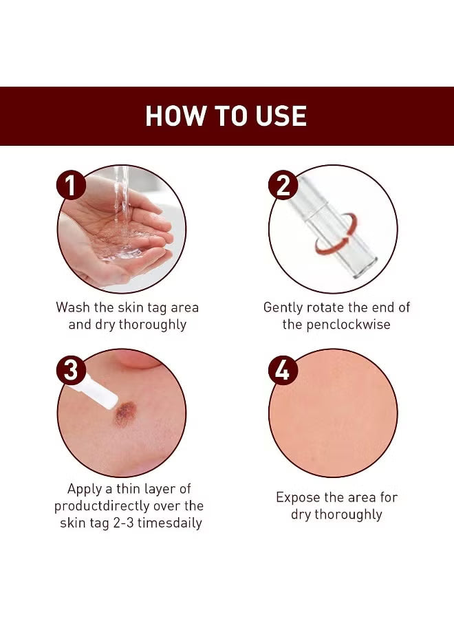 Wipe-Off Tags & Moles Remover Pen – Natural Tea Tree Oil Skin Tag & Mole Removal Care for Face, Neck & Body