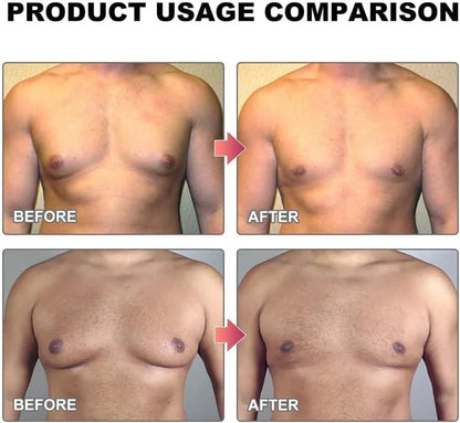 Gynecomastia Tightening Oil for Men.